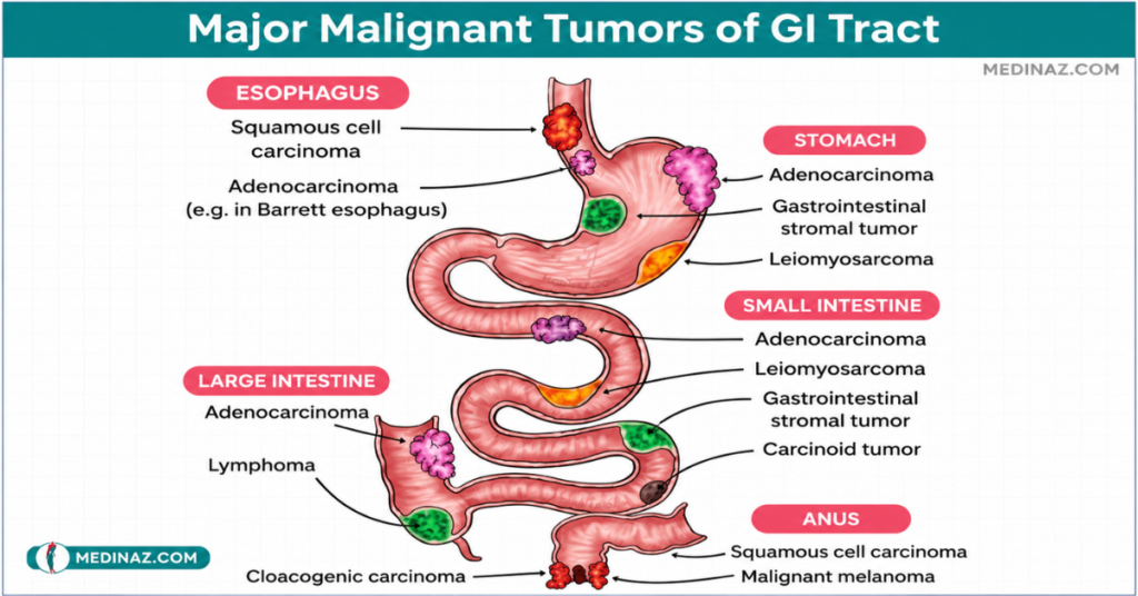 Upper GI Bleed:
