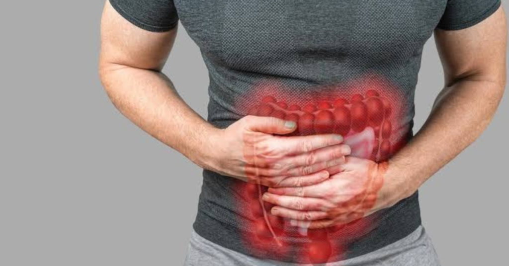 GI Bleed:
